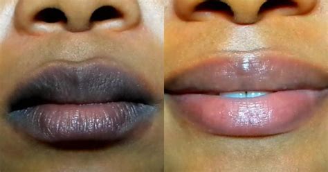 how to lighten dark lips instantly skin