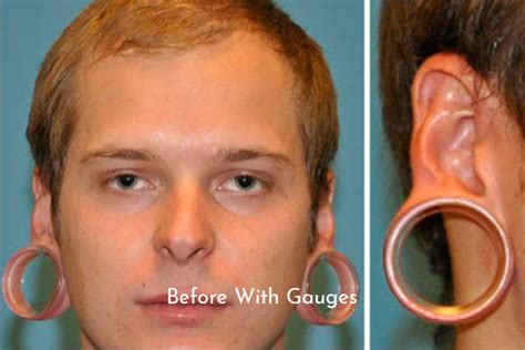 how appoint make a stop working in ear