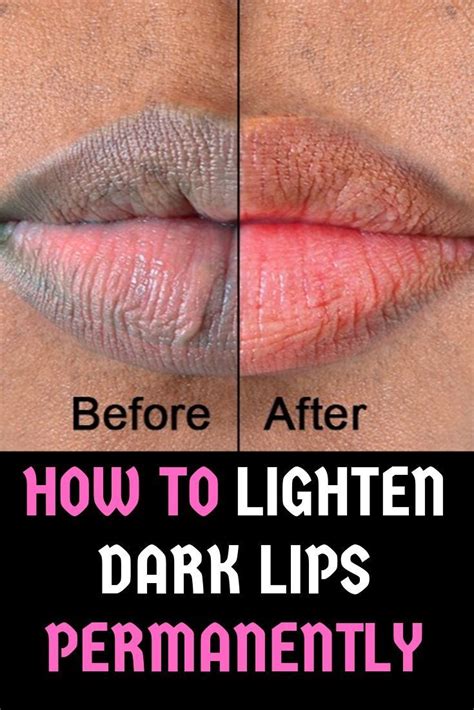how to make dark lips brighter naturally treatment