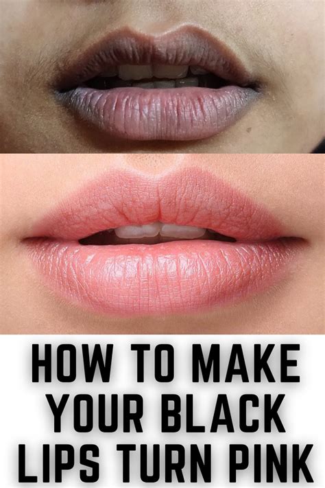 how to make dark lips pink faster naturally
