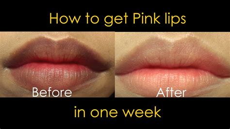 how to make dark lips pink naturally like
