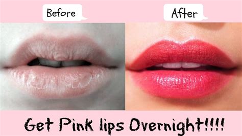 how to make dark lips pink naturally overnight
