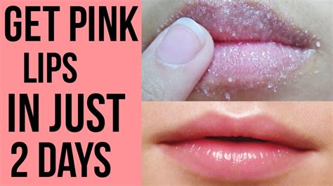 how to make dark lips pink naturally remedies