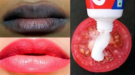 how to make dark lips red naturally overnight