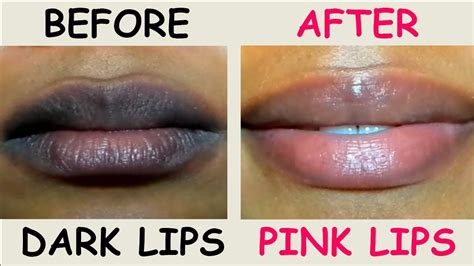 how to make dark lips red without medication