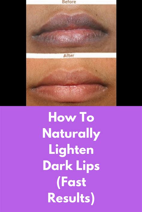 how to make dark lips red without medication