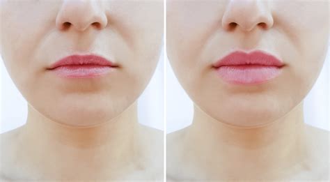 how to make full lips look thinner