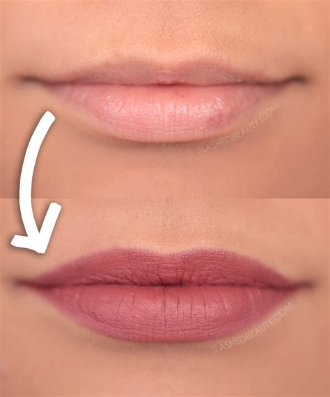 how to make lip iceland look realmedicine