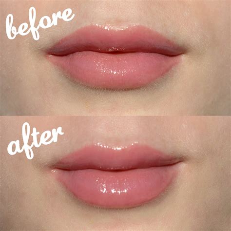 how to make lip icelandic acid gel cream