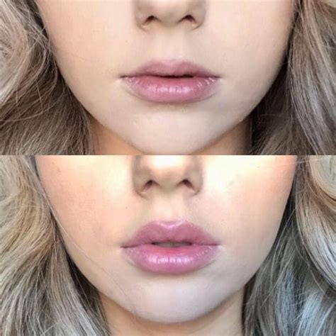 how to make lip plumper last longer