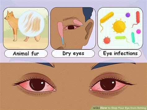 how to make my eyes stop itching