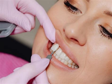 how to make your front teeth smaller