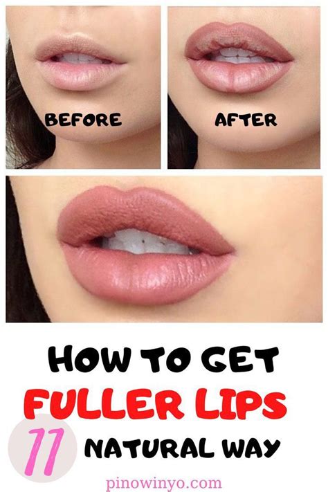 how to make your upper lip bigger naturally