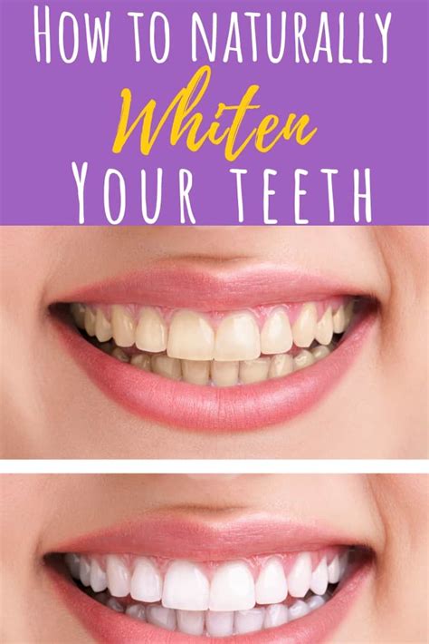 How To Naturally Whiten Your Teeth At Home White Science Teeth Whitening - White Science Teeth Whitening