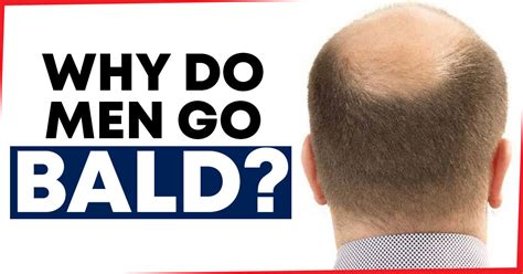 how to not go bald