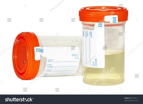 how to pee in a sample bottle