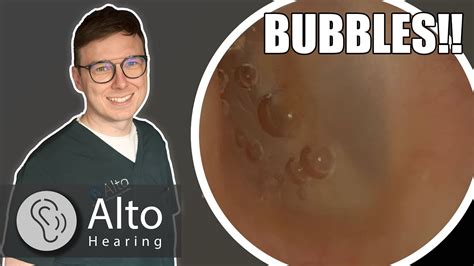 how to pop air bubble in ear