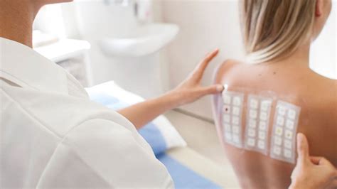 how to prepare for allergy testing
