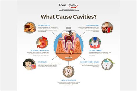 how to prevent cavity formation in teeth
