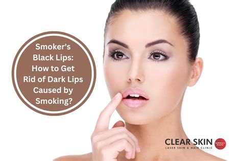 how to prevent dark lips from smoking