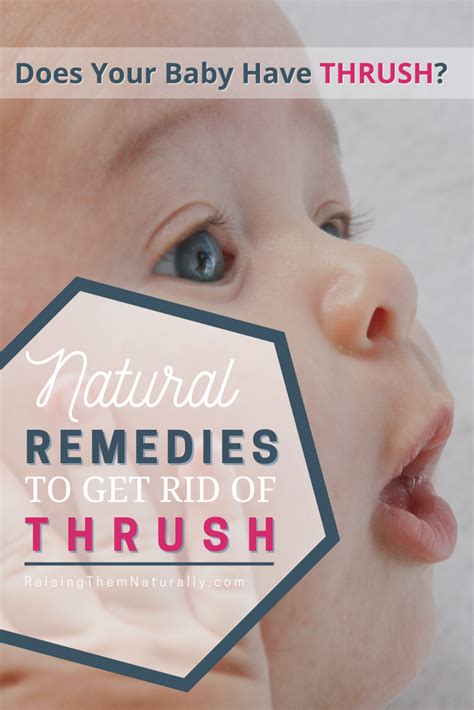 how to prevent thrush in babies