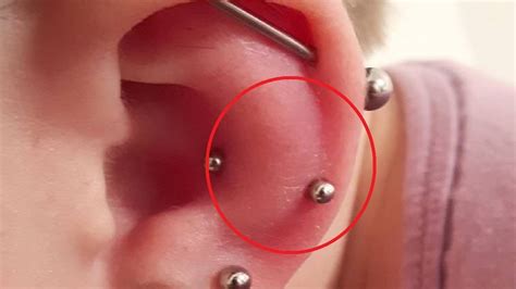 how to reduce ear piercing swelling