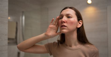 how to reduce flushing in face