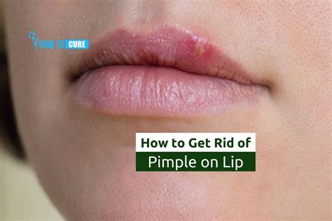 how to reduce lip swelling from pimple