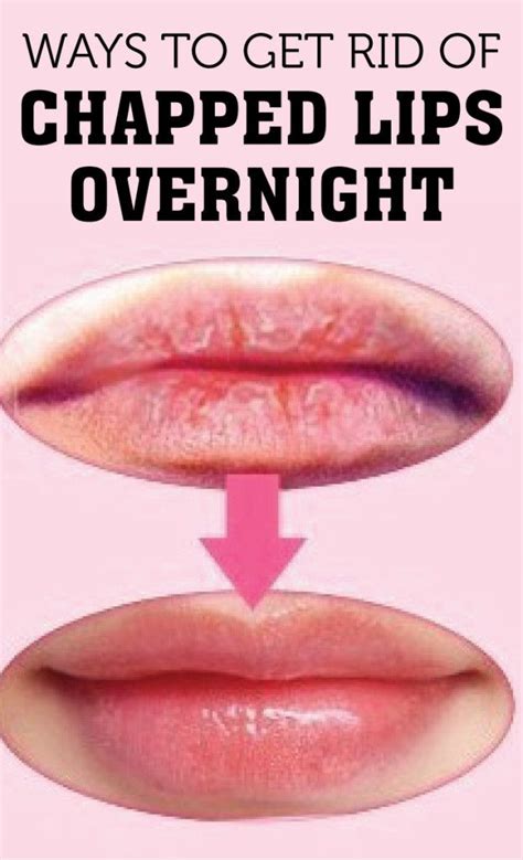 how to reduce lip swelling overnight skin