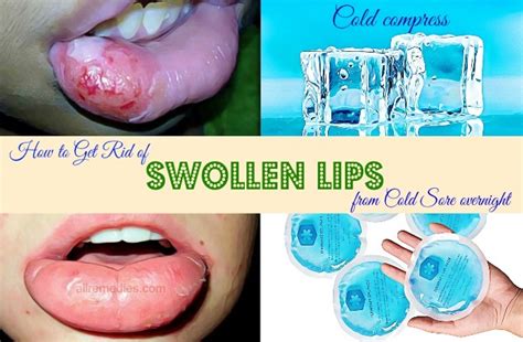 how to reduce lip swelling overnight without antibiotics