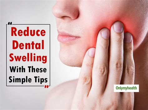 how to reduce swelling after dental implant surgery