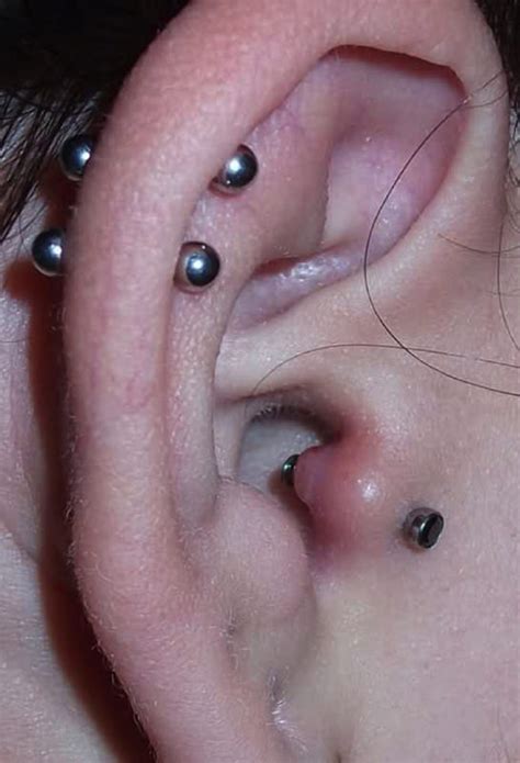 how to reduce tragus piercing swelling