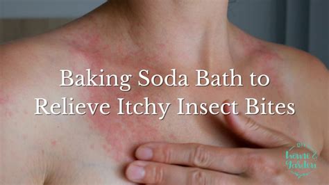 how to relieve itching from insect bites