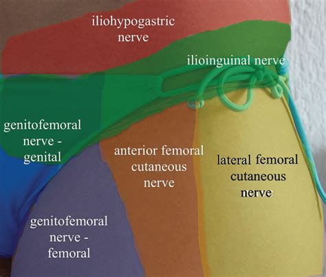 How To Remember Ilioinginal Vs Iliohypogastric Nerve Injury