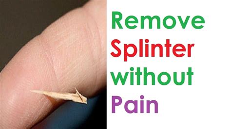 how to remove a splinter without pain