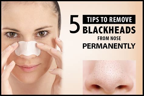 How To Remove Blackheads From Nose
