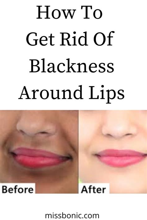 how to remove blackness under lips