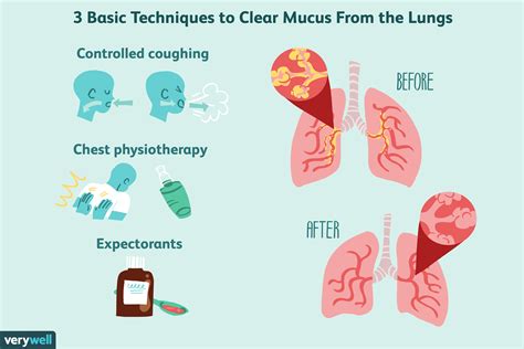 how to remove cough from chest