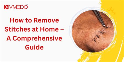 how to remove embedded stitches