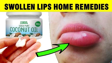 how to remove swelling from lips naturally