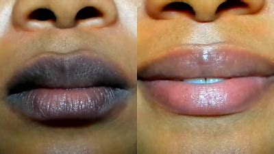 how to scrub dark lips without bleach treatment
