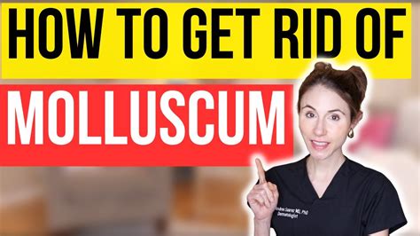 how to stop molluscum from itching