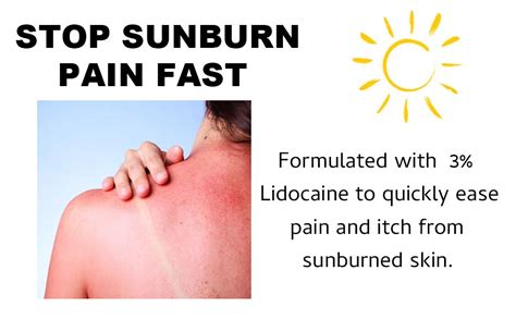 how to stop sunburn itch fast