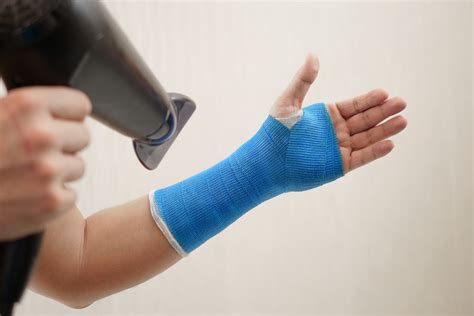 how to stop your cast from itching