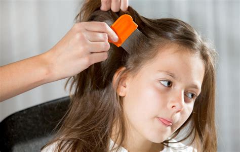 how to tell if kid has head lice