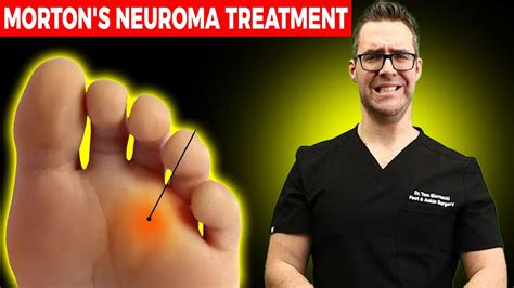 how to treat foot neuroma