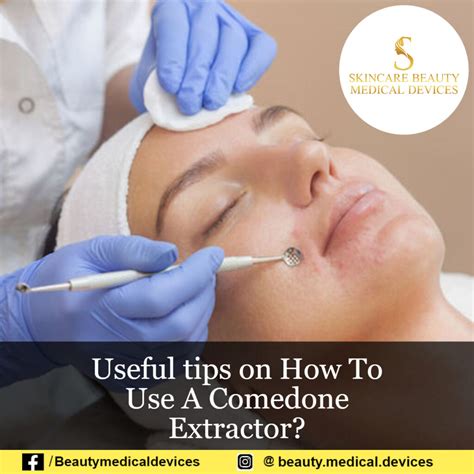 how to use a comedone extractor tool