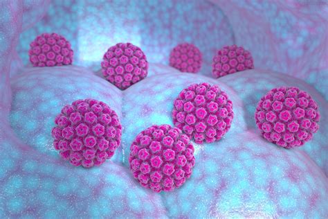 hpv virus soa