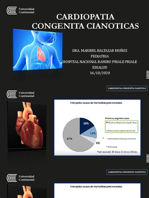 cardiopatia congênita