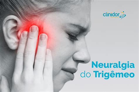 neuralgia do trigêmeo sintomas